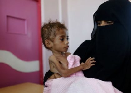Unicef dice que la guerra en Yemen es contra los niños